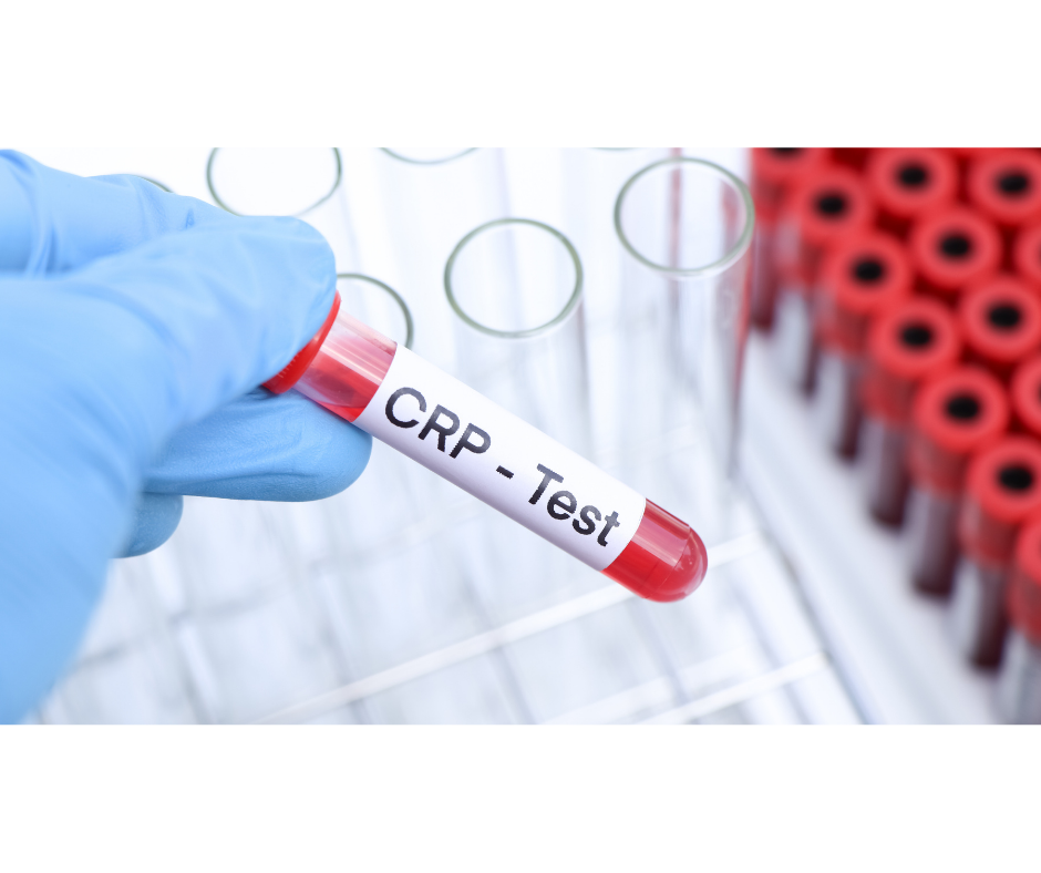 Zvýšené CRP – co znamená a kdy je vhodné vyšetření