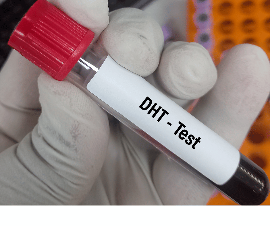 Dihydrotestosteron a jeho vyšetření, aneb proč je dobré hladinu tohoto hormonu hlídat