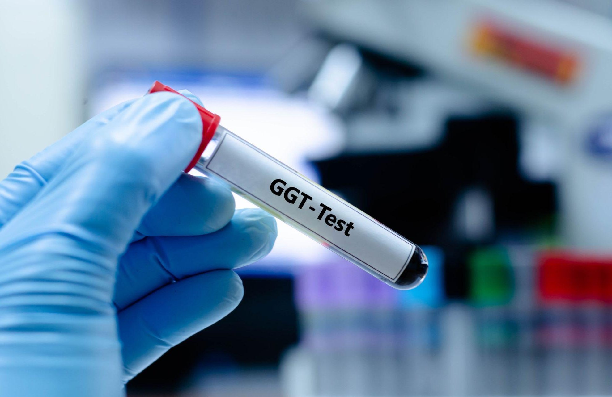 Zvýšené GGT – co znamená a kdy má smysl vyšetření