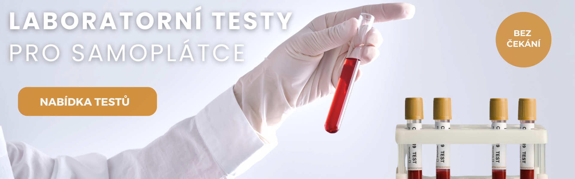 Laboratorní testy pro samoplátce
