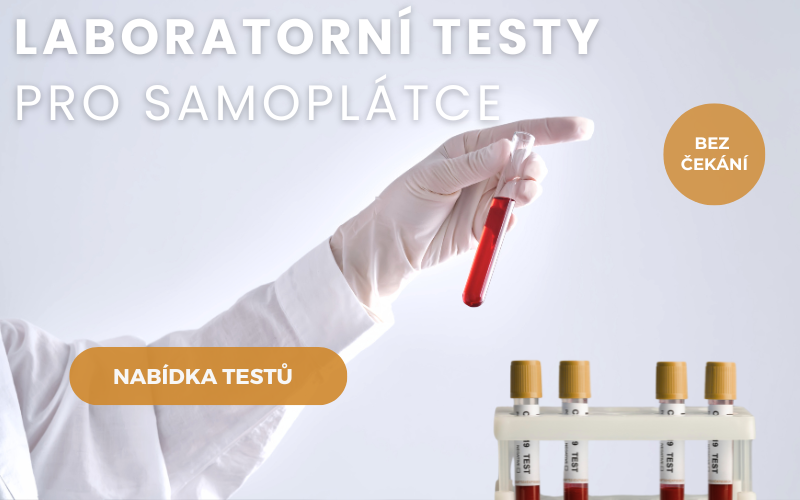 Laboratorní testy pro samoplátce