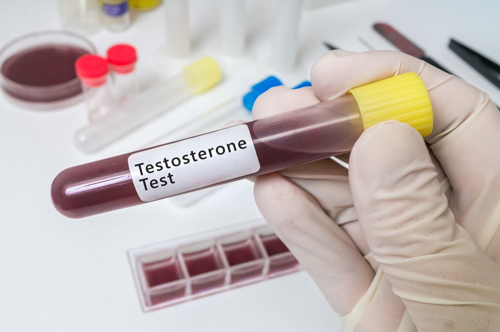 testosterr