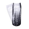 blaznive ponozky x ray rentgen 2