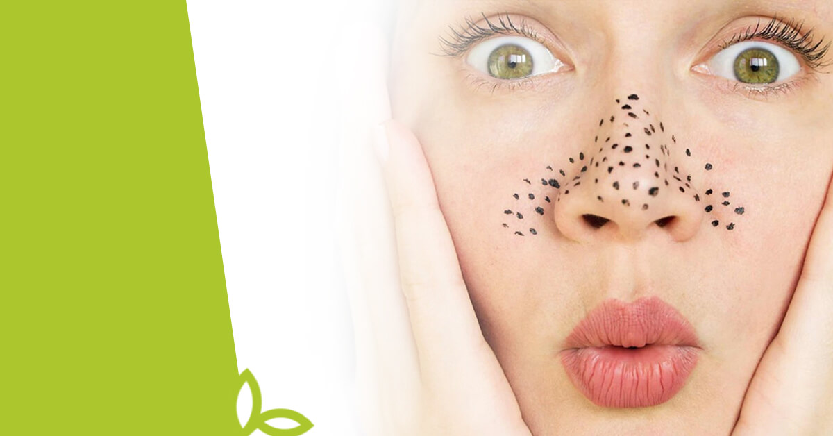 7 potravin, které mohou způsobovat akné