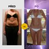 SLIMMING DUO  Versand ab dem 23. Oktober 2025