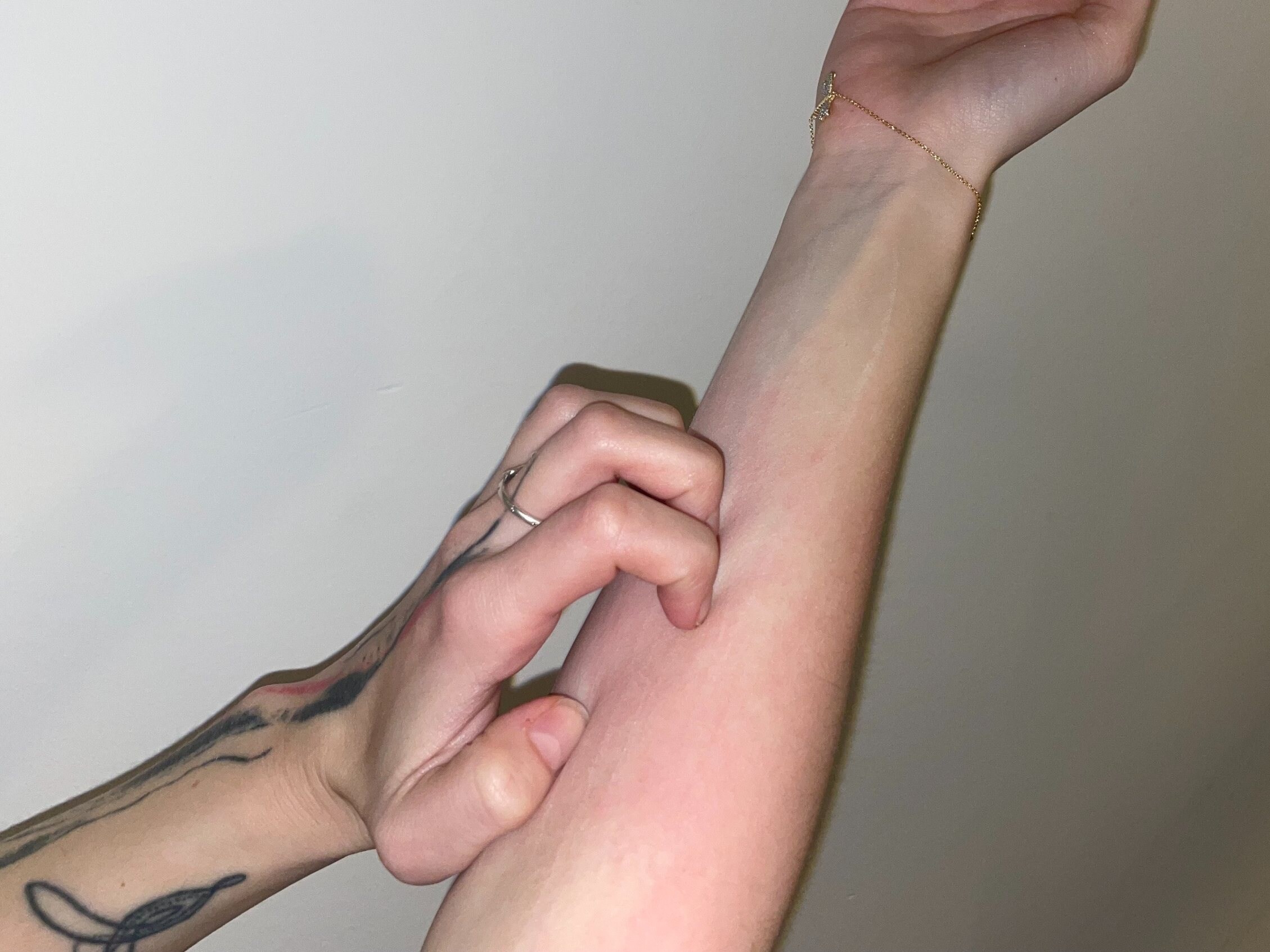 Konopí a kožní nemoci: Ekzém a svědění