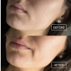 hydratacni esence hemptouch