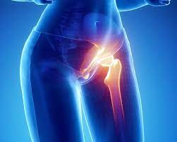 Ízületi fájdalmak, a gerincoszlop és reumatikus fájdalmak kezelése lézerterápiával