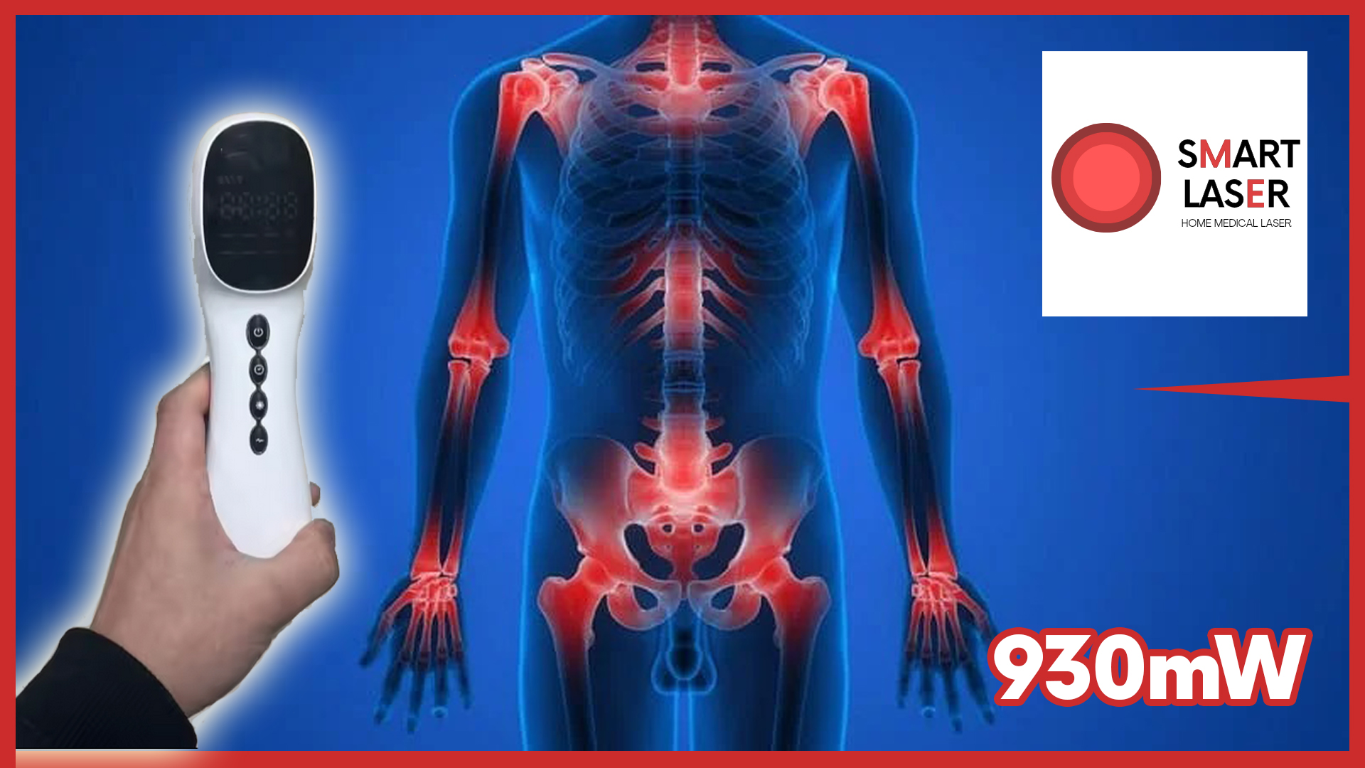 Smart Laser - HD-CURE PRO - Lézer fénylámpa - Laser Terápia