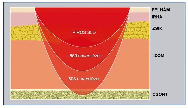 SmarLaserTerapia3