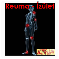 terapia-reuma-izulet-large