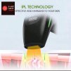 SMART LASER IPL Lézeres Szőrtelenítő készülék - Intensive Pulse Light