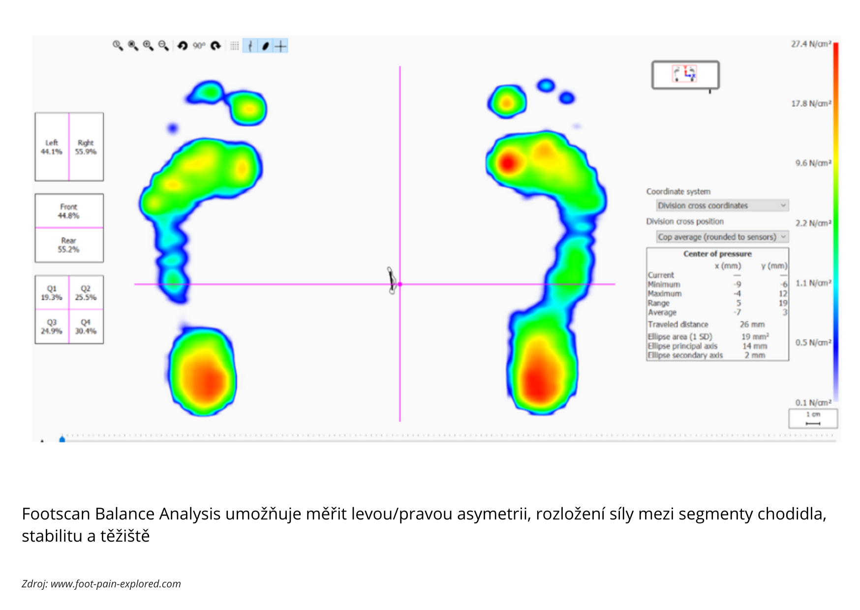 footscan