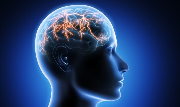 CBD bei der Behandlung von Epilepsie