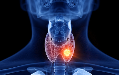 Schilddrüse - Funktion und Erkrankungen