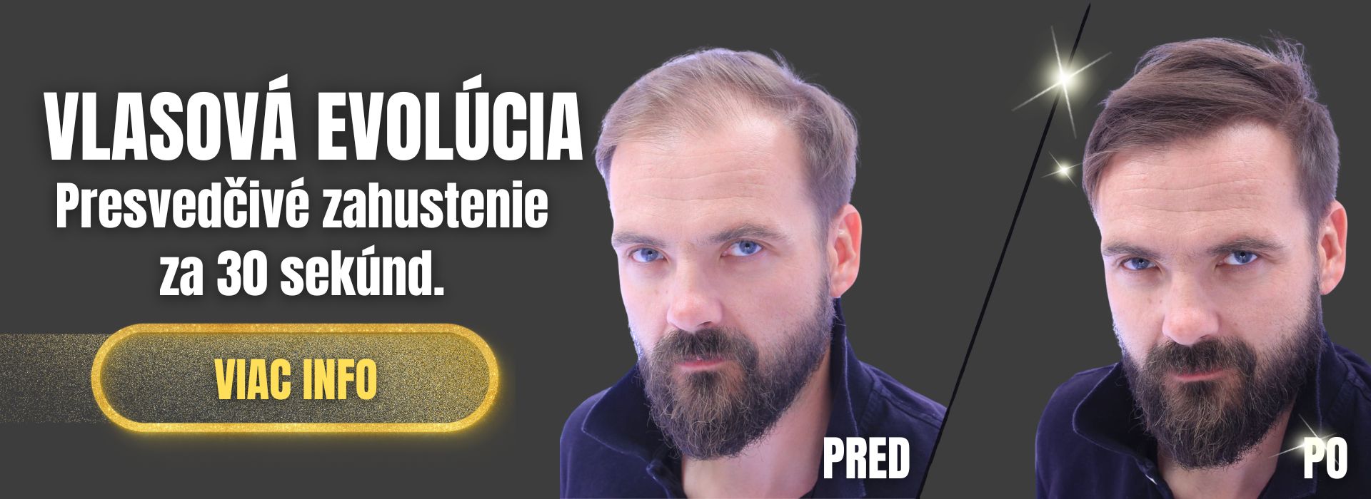 Zahusťovač vlasov pre husté vlasy