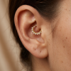 chirurgická daith