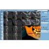 3DMid Surgical case