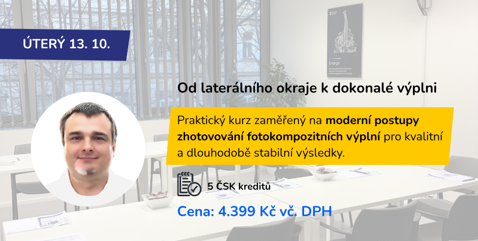 Od laterálního okraje k dokonalé výplni: Revoluce v kompozitech