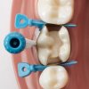 Palodent 360, 48ks