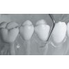 McCallova minikyreta 13S-14S/LM222-223M