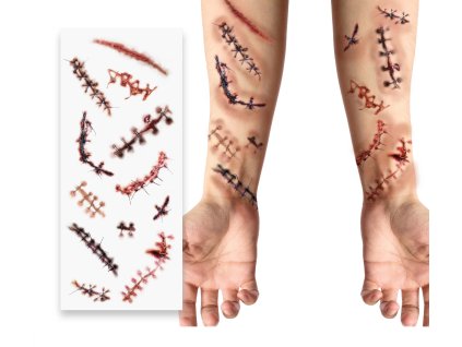100579 sada tetovani zosite rany