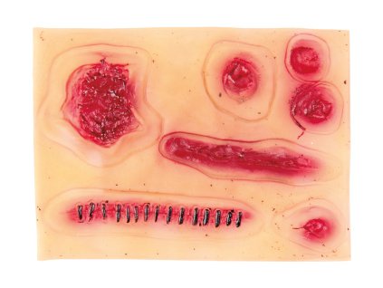 Ponarejene brazgotine