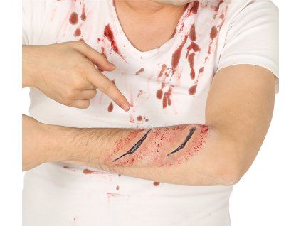 Jazva porezaná ruka