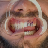 Real Corrector