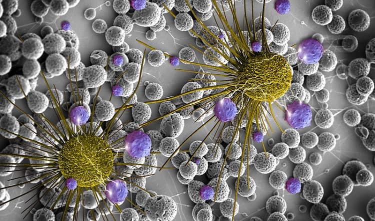 CBD olej a rakovina: nejrozsáhlejší průvodce na českém internetu