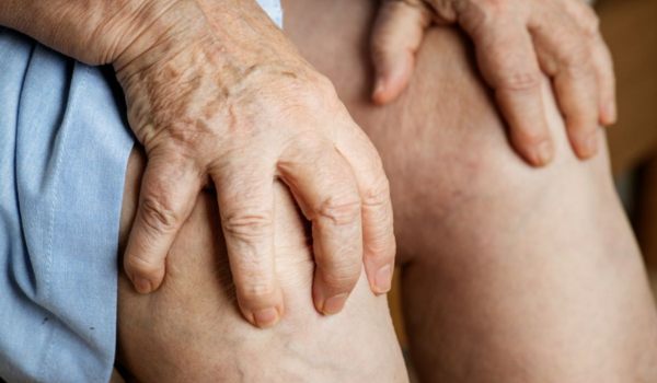 Dna a kyselina močová - prečo nám spôsobujú bolesti kĺbov a ako im predchádzať