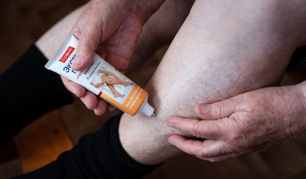 Hirudoterapia a extrakt z pijavice lekárskej: Prírodné riešenie pre kŕčové žily a zdravé nohy