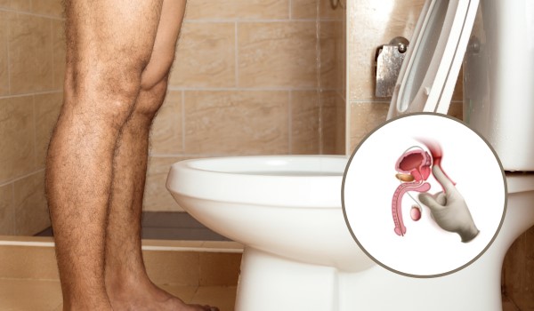 Ako udržať zdravú prostatu: Kompletný sprievodca
