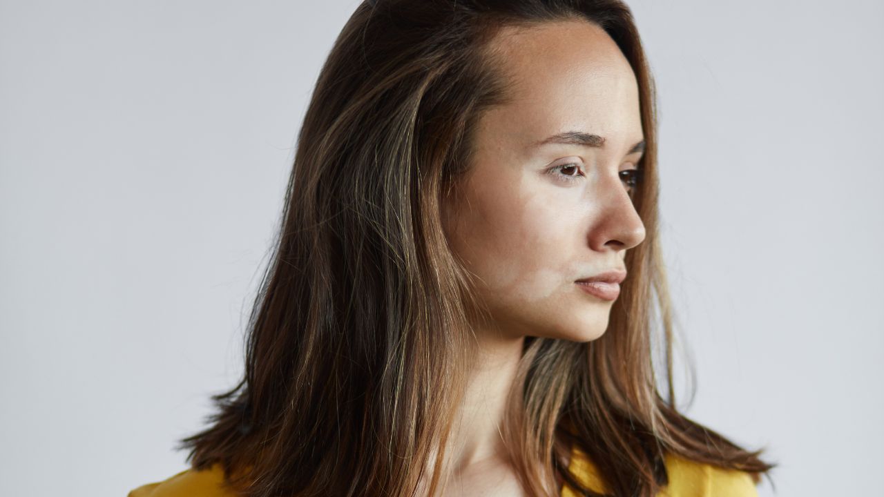 pigmentové škvrny na tvári