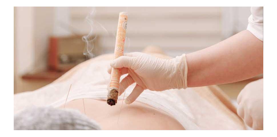 Moxování je receptem na zdraví a dlouhověkost