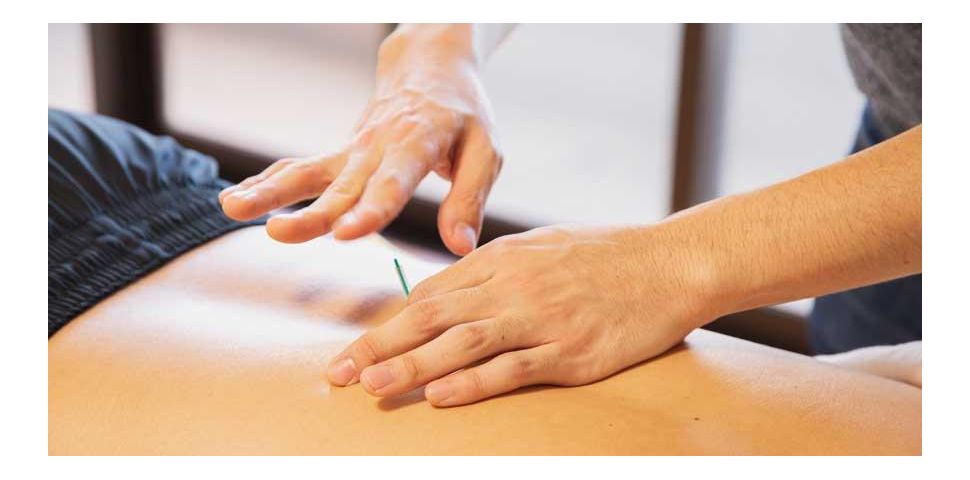 Akupunktura - igiełki zwalczające wiele dolegliwości