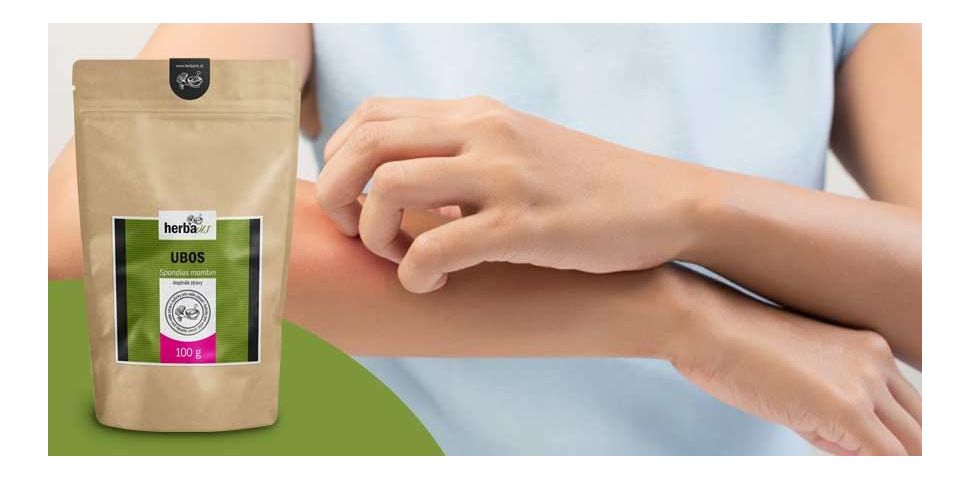 Ubos – Łuszczyca to problem, który dręczy ciało i duszę.