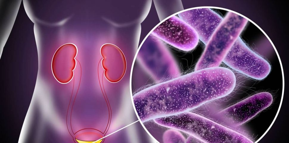 Infekcje dróg moczowych – jak leczyć je naturalnymi sposobami i co zrobić, by im zapobiec?