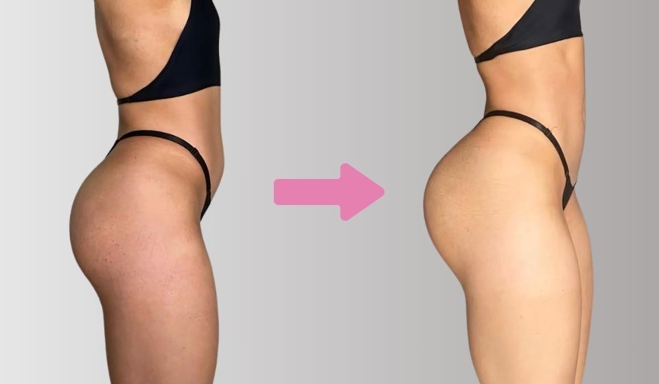 Jak přibrat na zadku? Osvědčený návod, který funguje
