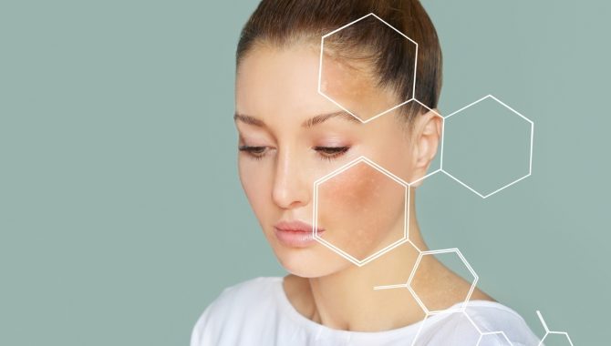 Rozlučte se s pigmentovými skvrnami – najednou a bylinkově