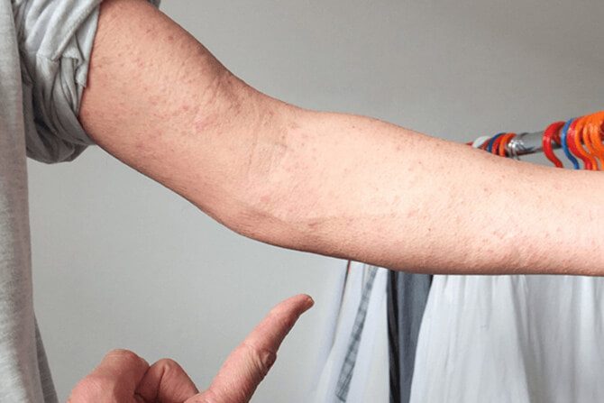 Jak vybrat oděv, který nepodráždí vaši pokožku