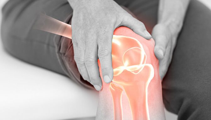 Artróza - jak jí nepodlehnout! Pár kroků k její prevenci