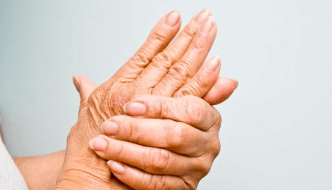 Revma | Příčiny, příznaky, léčba