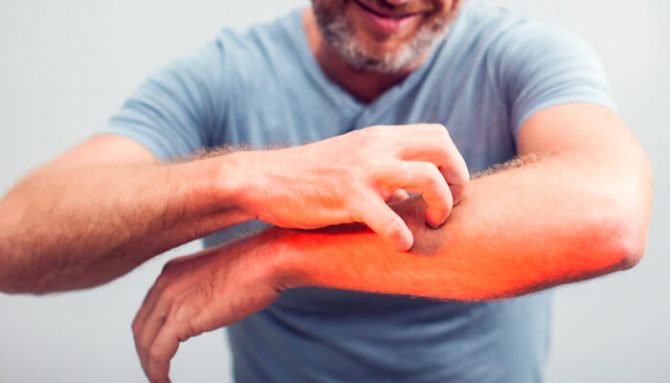 Svědění těla: Odhalte příčinu vycházející zevnitř