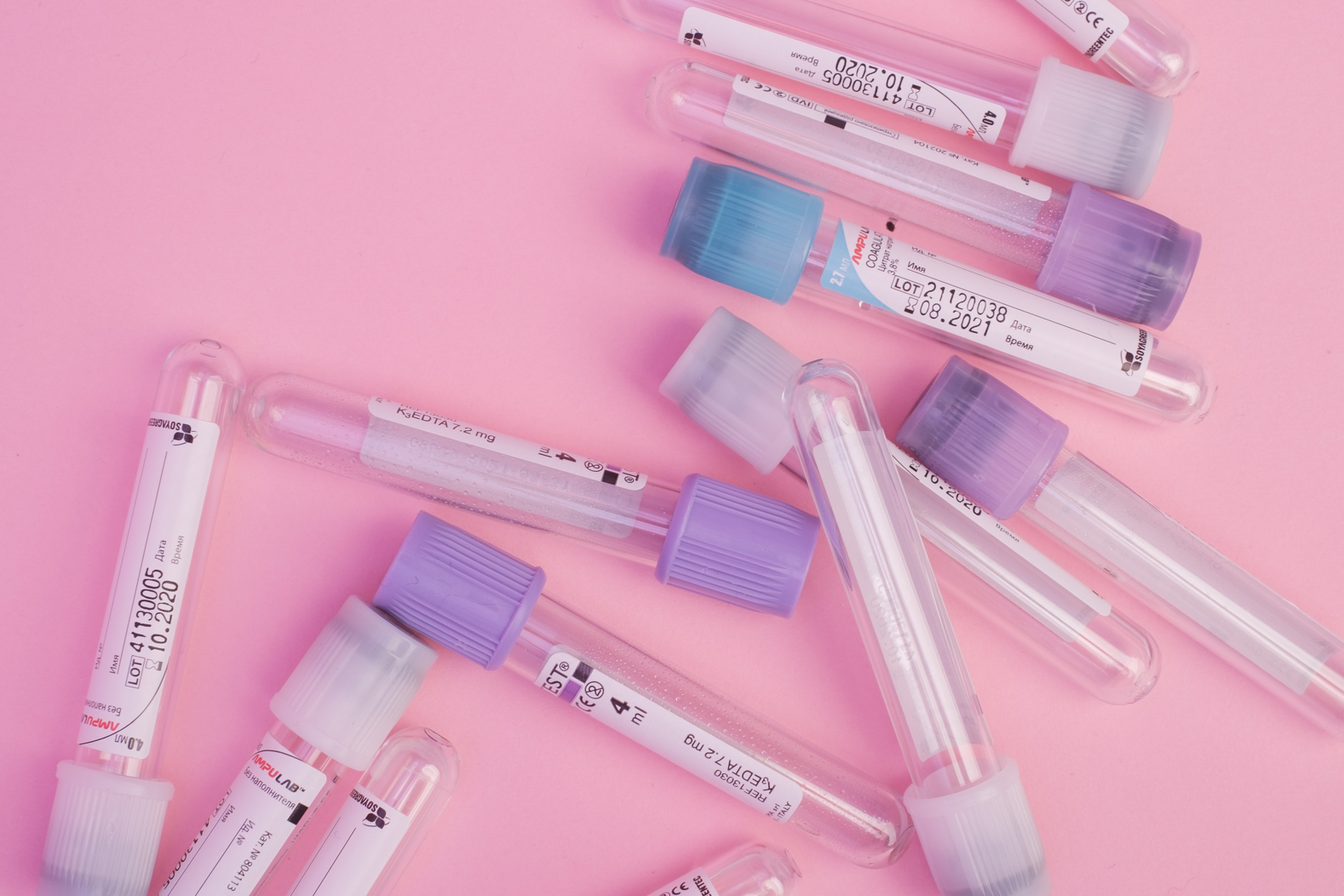 Ktoré parametre si dať vyšetriť pre diagnostikovanie PCOS