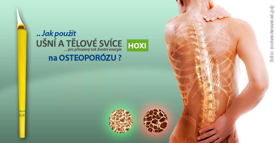 Aplikace tělových svící HOXI na Osteoporózu