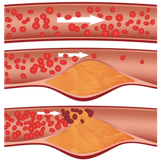 Cholesterol v krvi