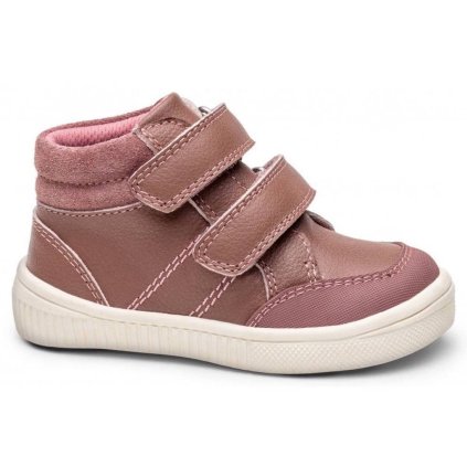 protetika Abigail old pink