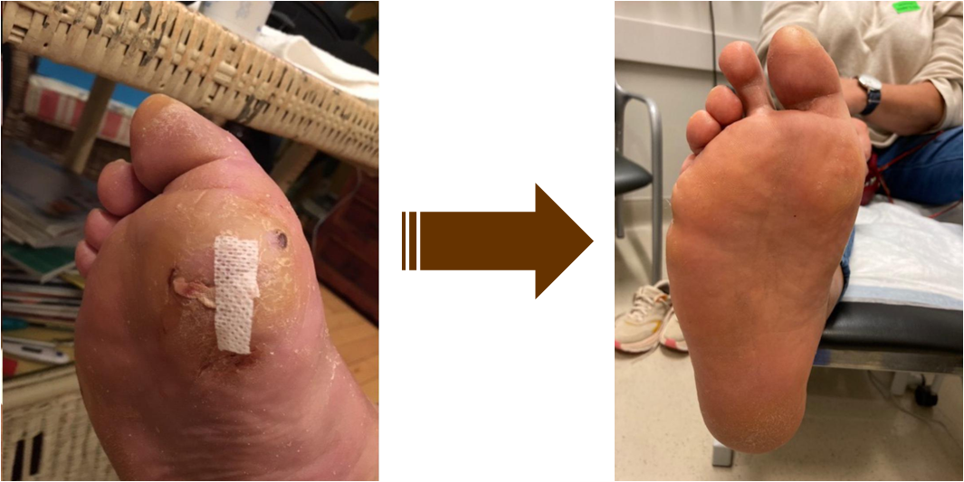 Můj příběh s HUMAC Nativem