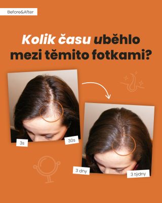 Mezi těmito fotkami neuběhly týdny ani dny. Uběhlo přibližně 30 vteřin 🕐 Přesně tolik času stačí k tomu, aby řídká místa...